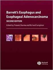 Barretts Esophagus and Esophageal Adenocarcinoma, (1405127864 