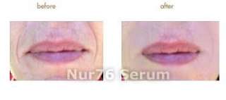 Nur76 ADVANCE Anti Wrinkle Serum Hyaluronic Acid Skin  