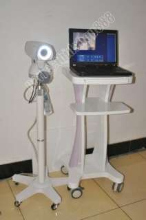 CE Digital Electronic Colposcope with 830.000 Pixels Sony Camera 