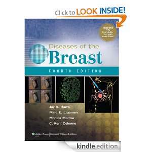 Breast (Diseases of the Breast (Harris)) Monica Morrow, Jay R. Harris 